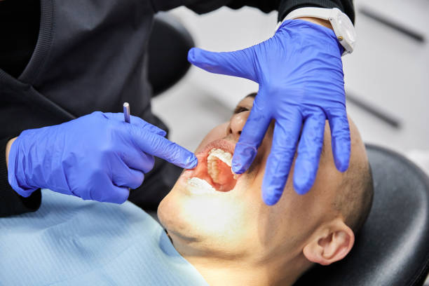 Best Cracked Tooth Emergency Dentist  in Secaucus, NJ